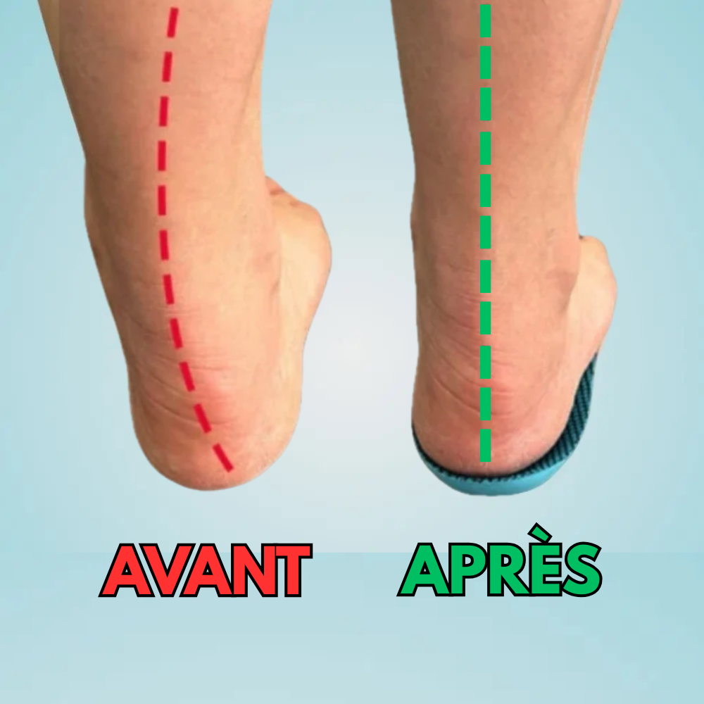 ConfortFlex® – Soulagez vos pieds dès aujourd’hui, sans rendez-vous ni médicament