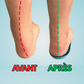 ConfortFlex® – Soulagez vos pieds dès aujourd’hui, sans rendez-vous ni médicament