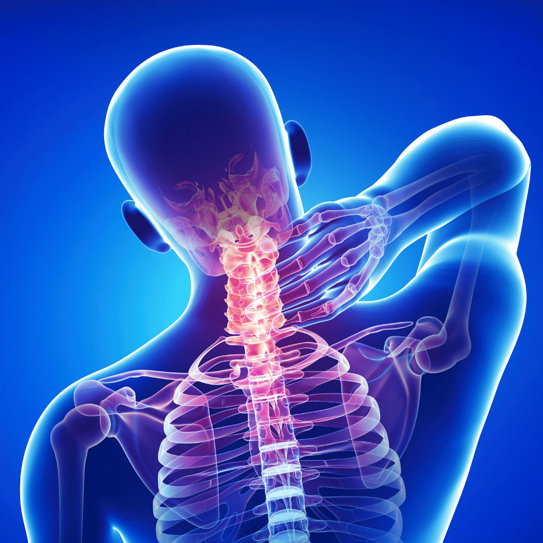 Soulagement efficace des douleurs cervicales et des épaules Image