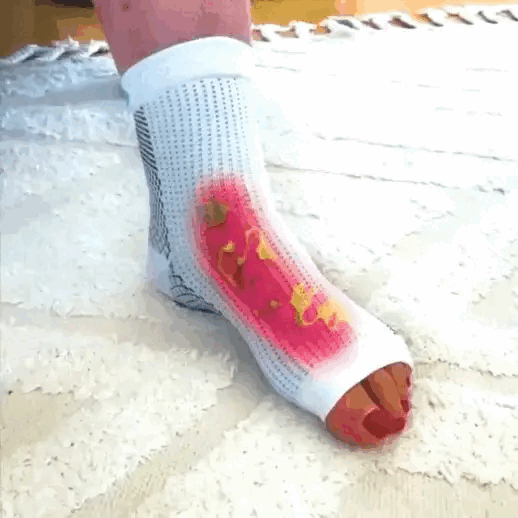 Circulation améliorée orthosocks