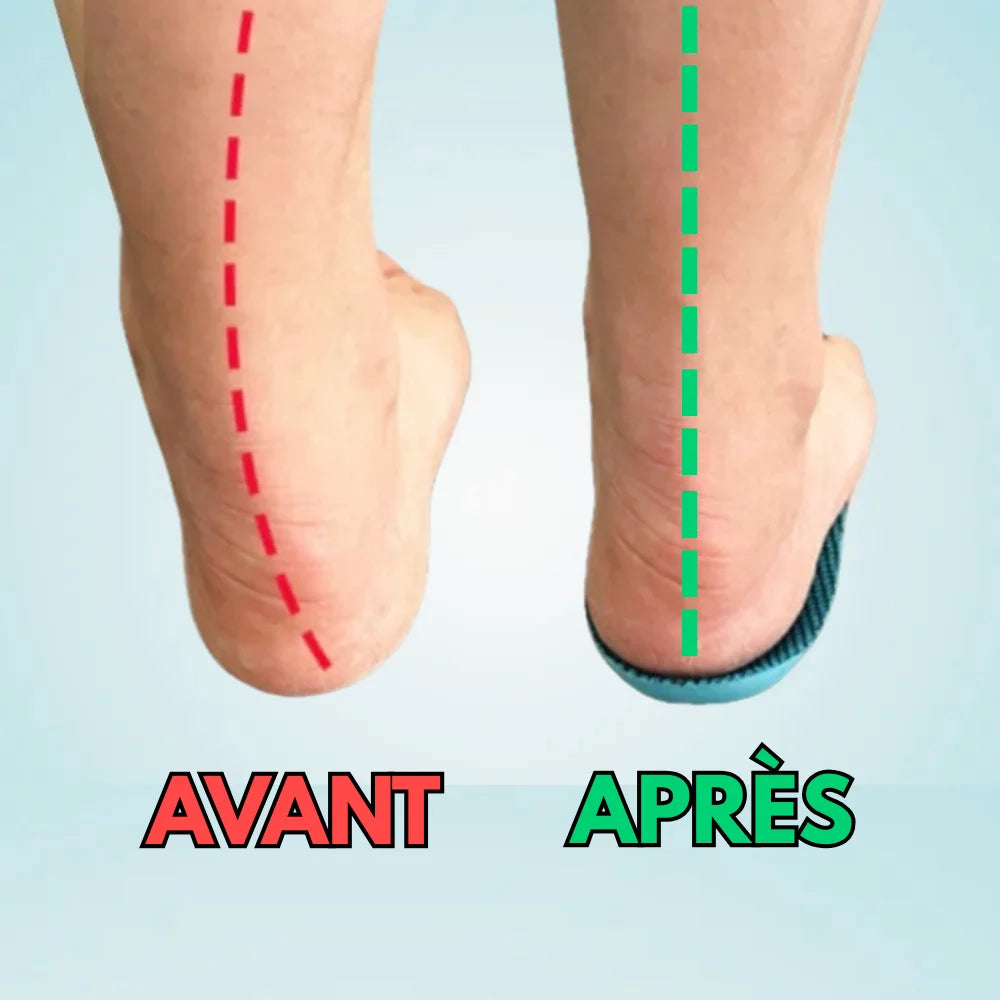 ConfortFlex® – Plus de douleur aux pieds en 14 jours - Semelles pour l’hallux valgus et la voûte plantaire - Nuage Confort