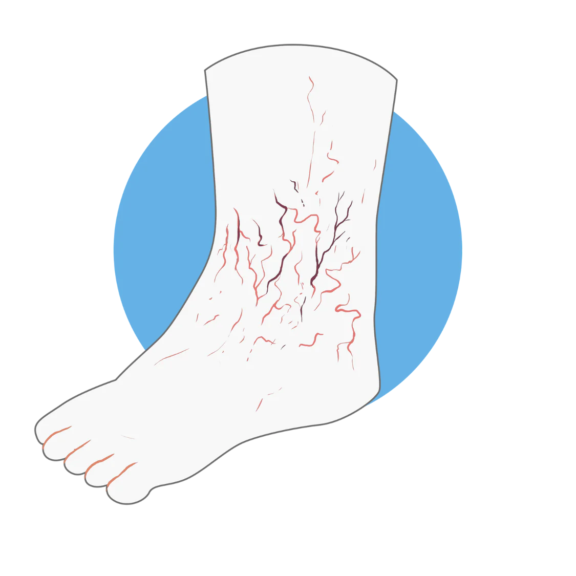 Logo Neuropathie Diabétique Image