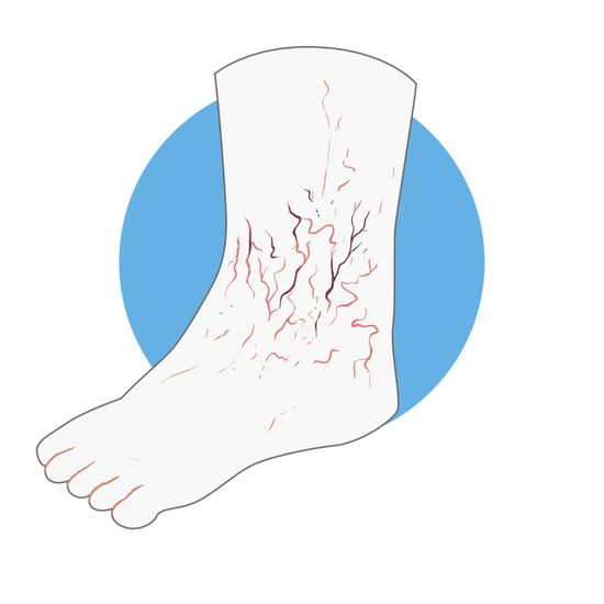 Logo Neuropathie Diabétique