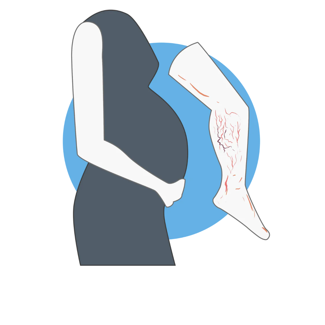 Logo Œdème pendant la grossesse Image