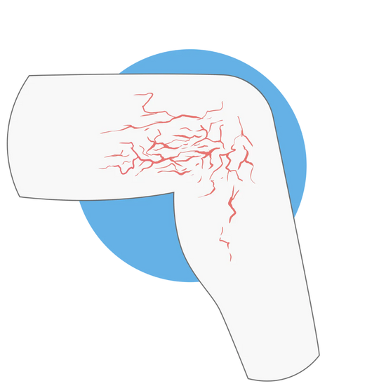 Logo Thrombose