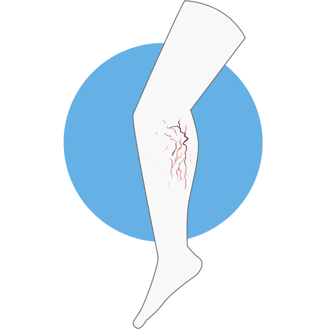 Logo Varices Image