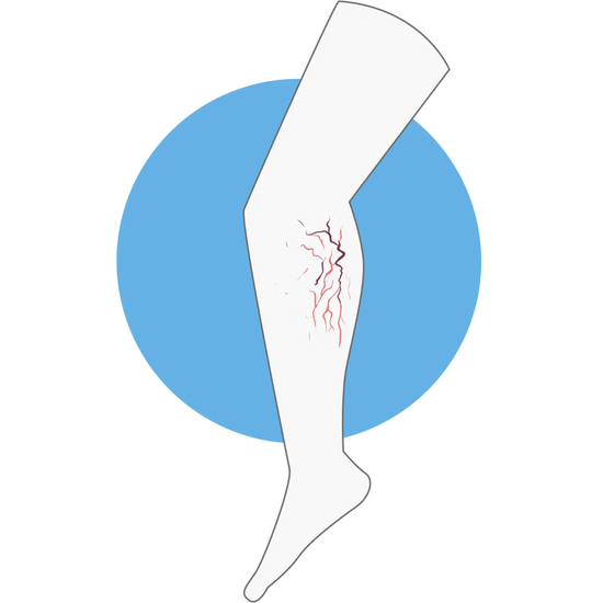 Logo Varices