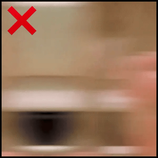 Utilisation de la chevillère OrthoBand Image