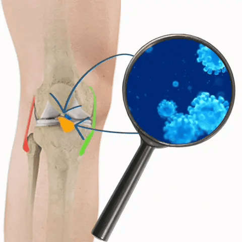 Votre genou souffre - vieactive