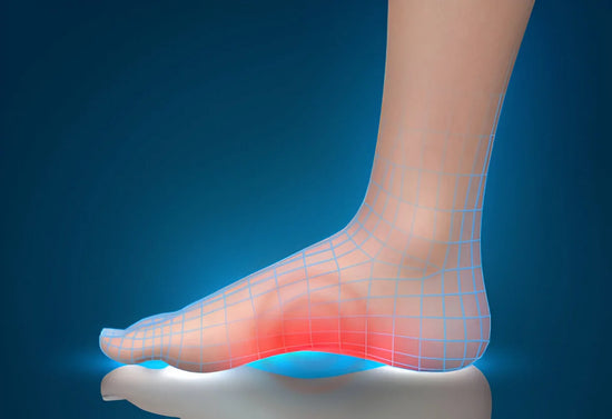 voûte plantaire inflamée